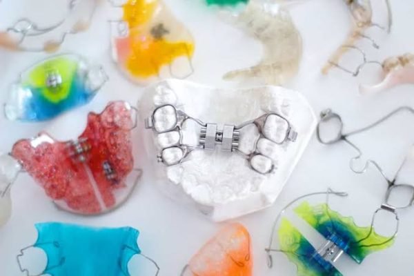 Orthodontic Appliances.jfif